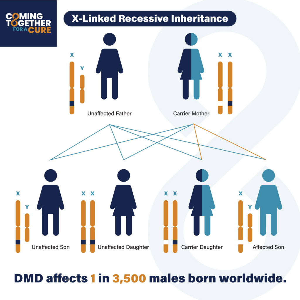 Who is Affected by DMD Graphic